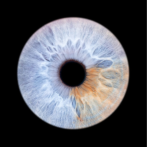 1 Eye